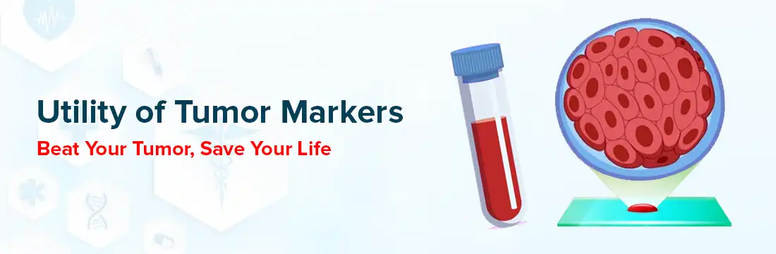 Utility of Tumor Markers: Beat Your Tumor, Save Your Life